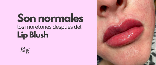 Son normales los moretones después del Lip Blush
